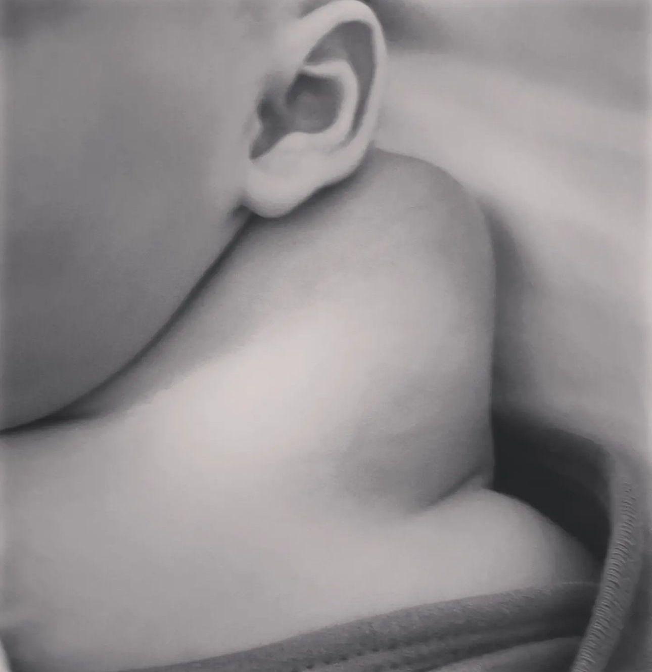 Çocuk Tümörlerinin Cerrahi Tedavisi